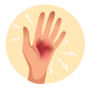 Hand and Wrist pain